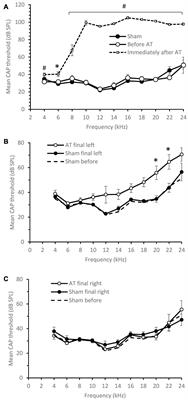 Hearing Loss Increases Inhibitory Effects of Prefrontal Cortex Stimulation on Sound Evoked Activity in Medial Geniculate Nucleus